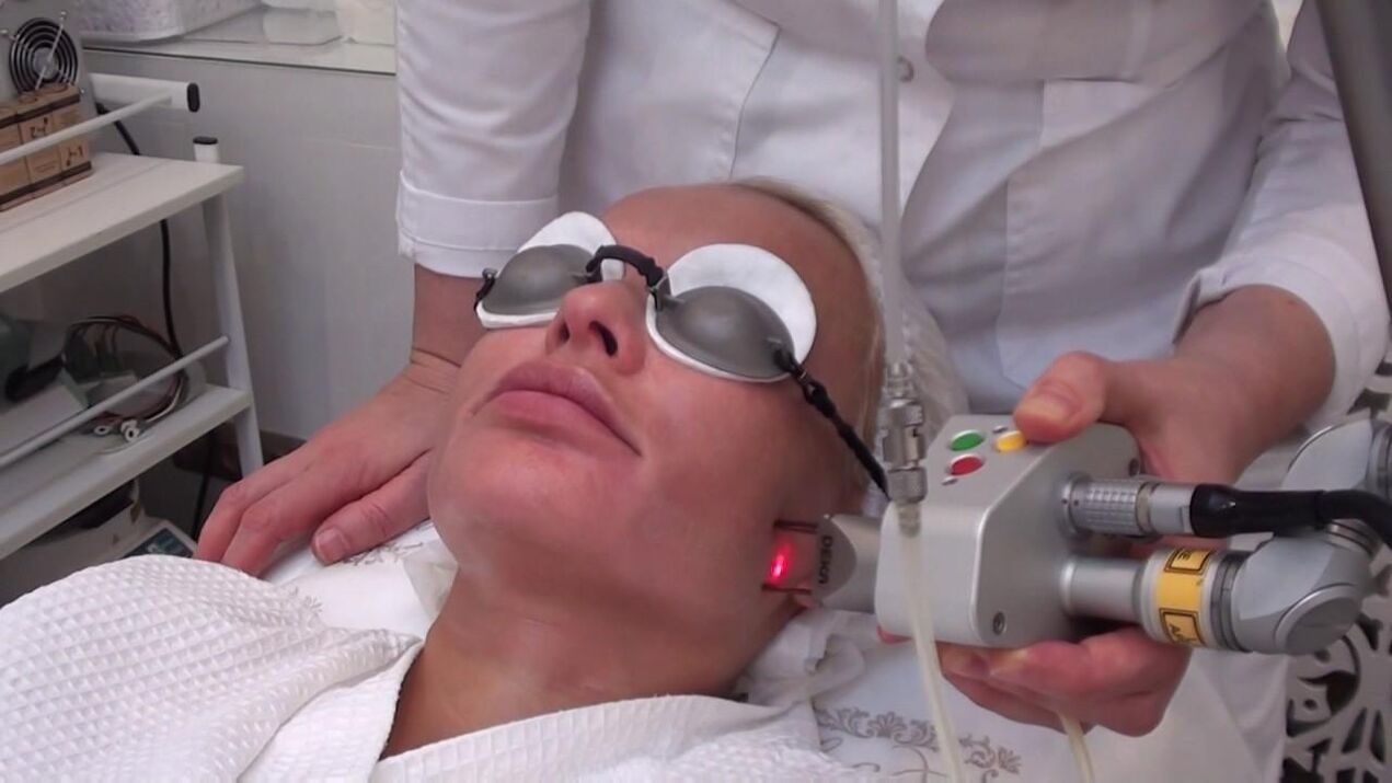 Rawatan dengan pancaran laser pada kawasan kulit wajah yang bermasalah